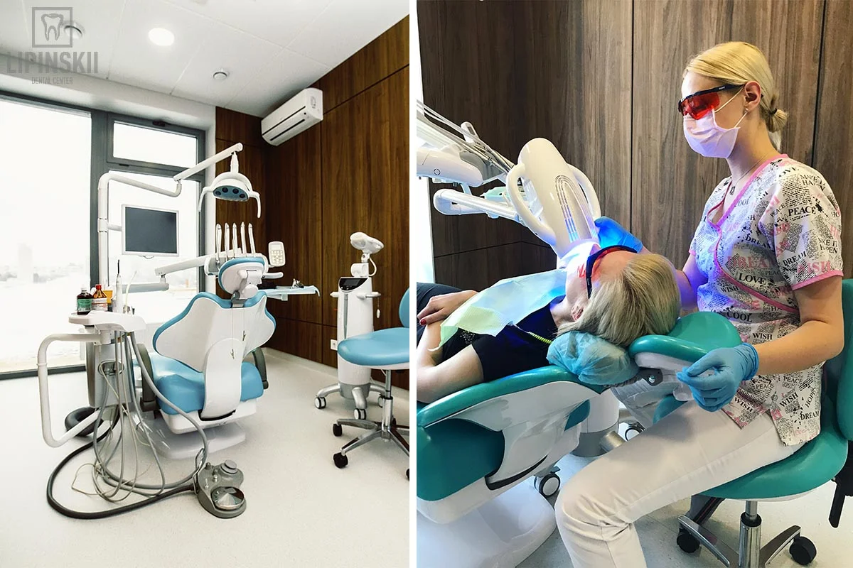 Benefits of teeth whitening Beyond Polus Kiev