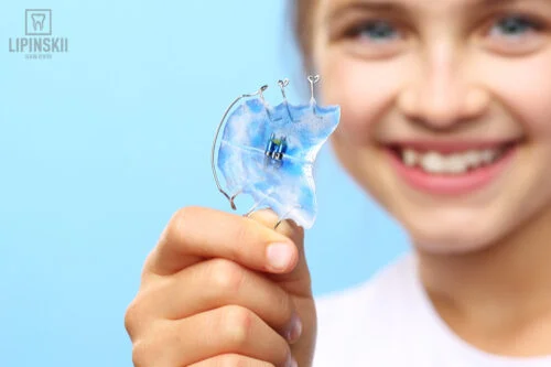 How long should braces be worn?