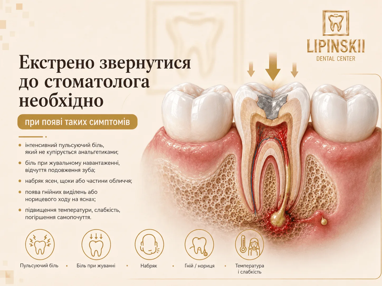 Коли потрібно терміново звернутися до стоматолога при запаленні кореня зуба