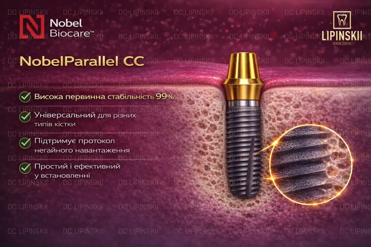 Імплант Nobel Parallel CC з прямим профілем і конічним з’єднанням для стабільності