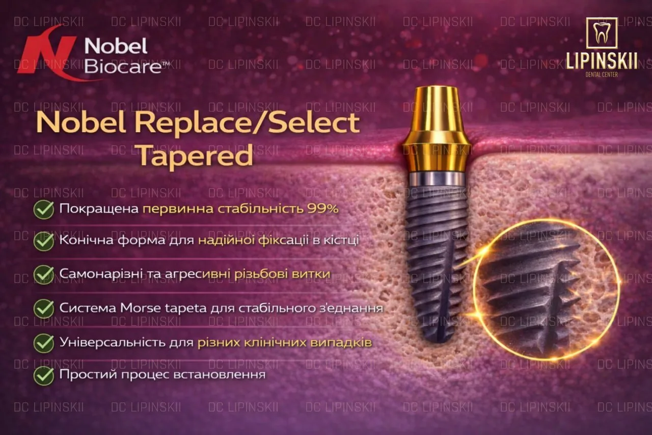 Імплант Nobel Replace/Select Tapered для відновлення зубів у пацієнтів з різними типами кістки