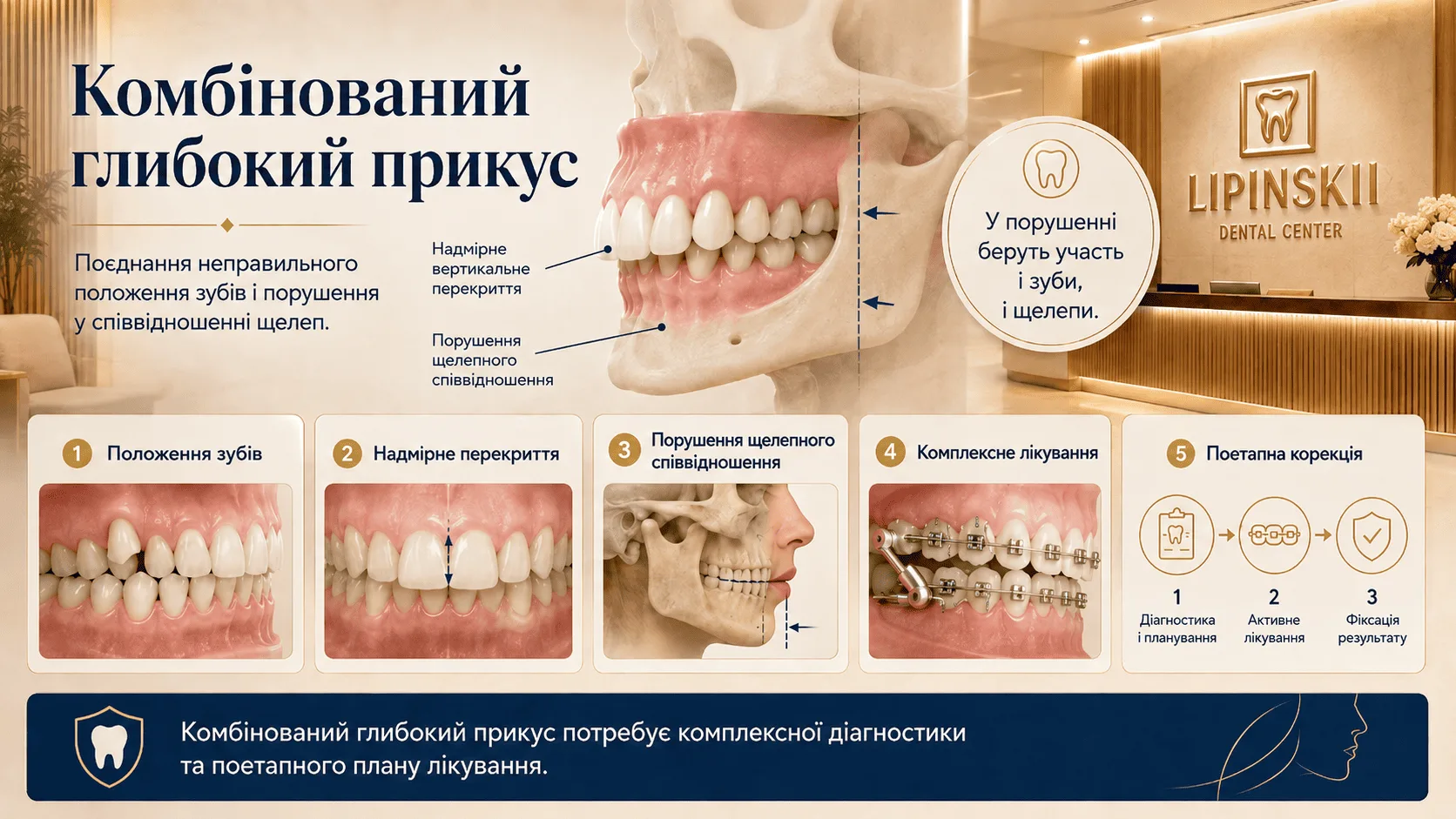 Комбінований глибокий прикус: поєднання зубних і щелепних порушень