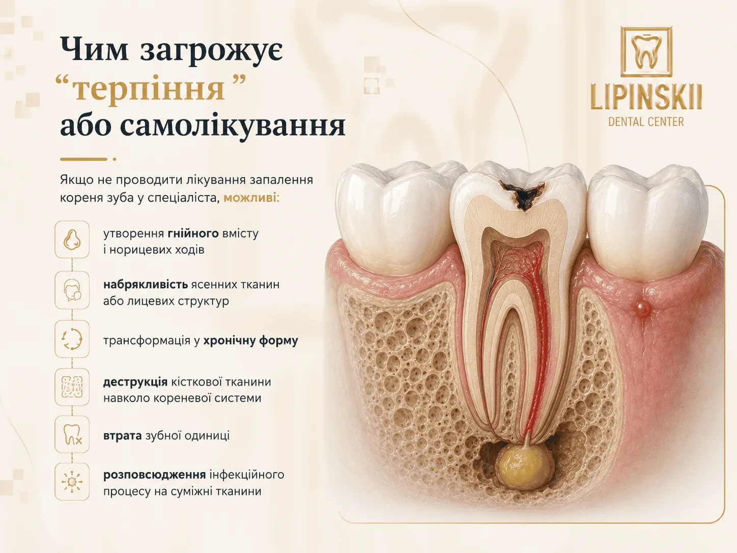 Наслідки нелікованого запалення кореня зуба без звернення до стоматолога