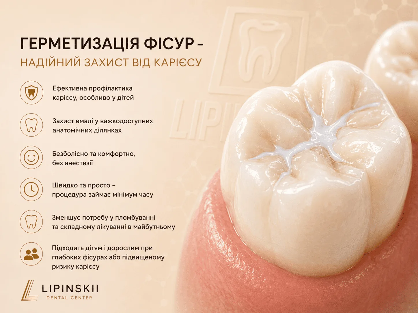Переваги герметизації фісур для захисту жувальних зубів від карієсу