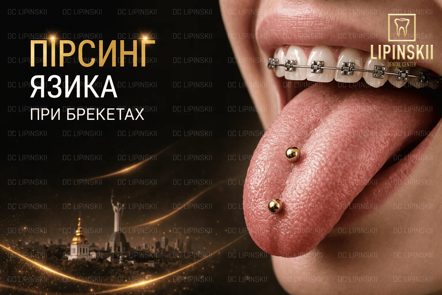 Пірсинг язика при брекетах
