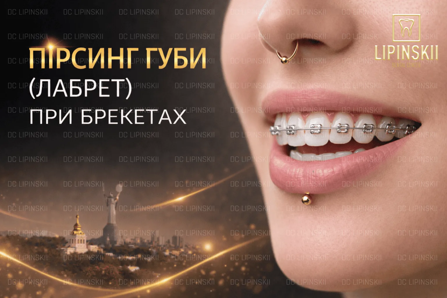 Пірсинг губи лабрет при брекетах
