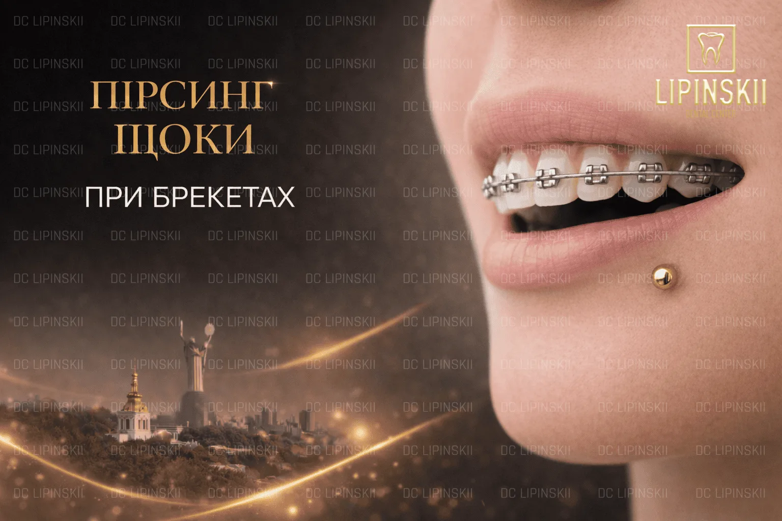 Пірсинг щоки при брекетах