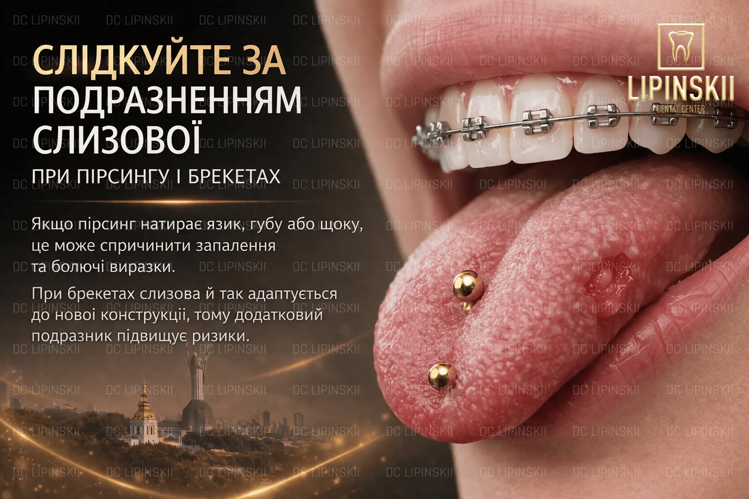 Подразнення слизової при пірсингу та брекетах