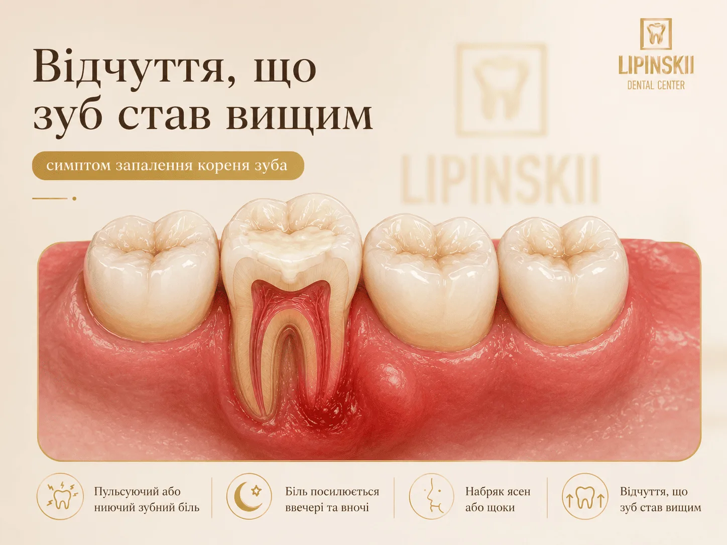 Відчуття що зуб став вищим при запаленні кореня зуба
