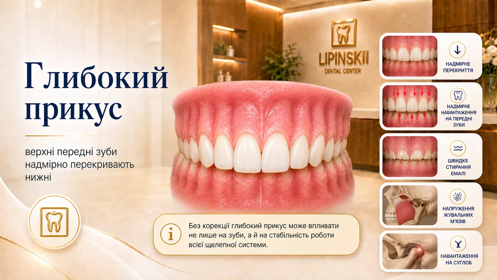 Глибокий прикус: причини, наслідки та сучасні методи лікування