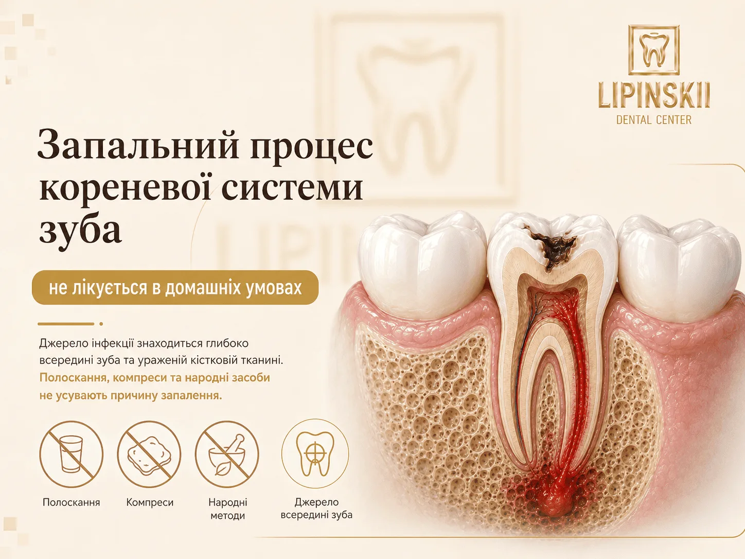 Запальний процес кореневої системи зуба при підозрі на запалення кореня